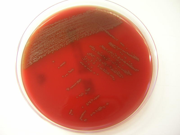 Streptococcus_tigurinus_uj_bakterium