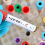 koronavirus_teszt_vizsgalat_negativ