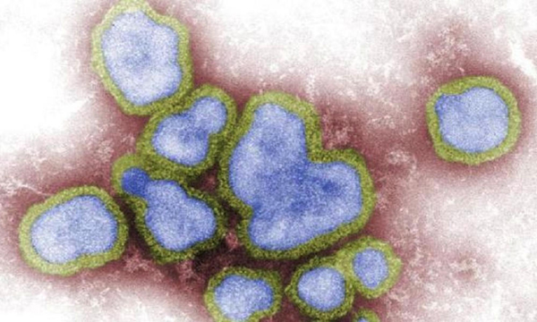 H3N8_influenzavirus