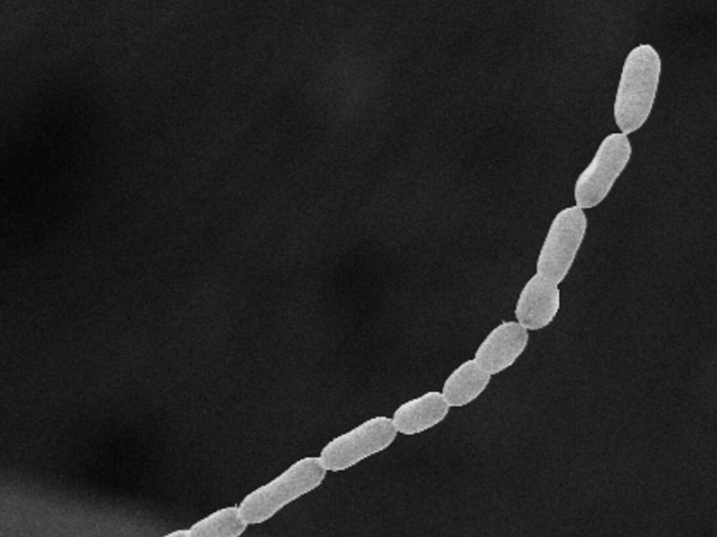 Filaments of Ca. Thiomargarita magnifica. A team of researchers at the Department of Energy (DOE) Joint Genome Institute (JGI), Lawrence Berkeley National Laboratory (Berkeley Lab), the Laboratory for Research in Complex Systems (LRC), and the Université des Antilles], have characterized a bacterium composed of a single cell that is 5,000 times larger than other bacteria. The bacteria, Ca. Thiomargarita magnifica, discovered in the French Caribbean mangroves is a member of the genus Thiomargarita. Image by Tomas Tyml