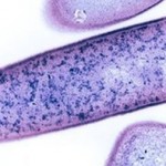 Clostridium_difficile_bakterium
