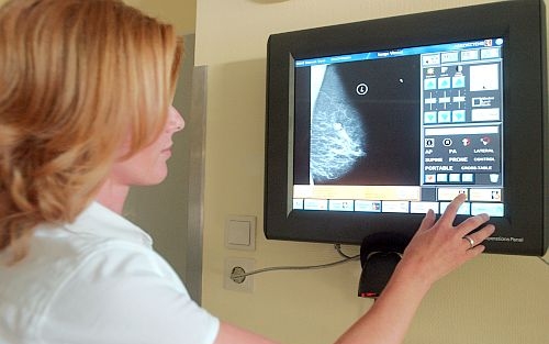 János kórház mammográfia